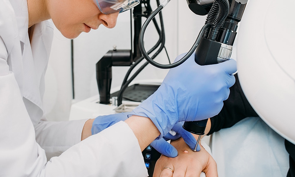 Chirurgie dermatologique